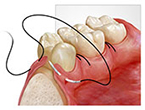 oral surgery